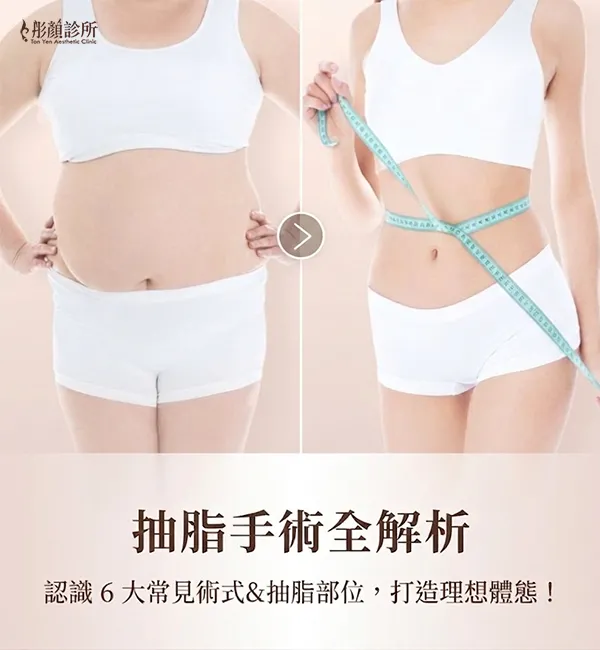 抽脂-抽脂效果-醫美抽脂推薦