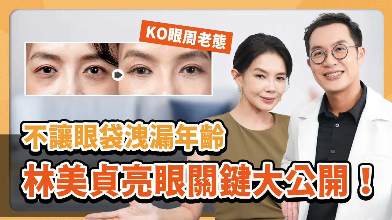 【媒體報導】年輕人也遮不住的累！視覺年齡被「眼神」出賣　醫師：眼袋才是讓臉顯老的最大破綻