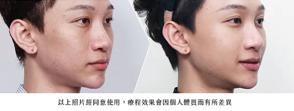 超級煥顏術- 增加肌膚彈性與光澤