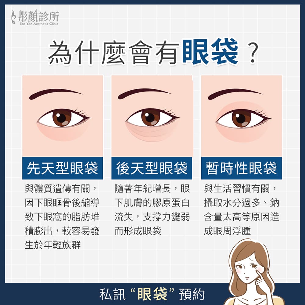 眼袋成因-眼袋手術-眼袋手術推薦-內開外開差異
