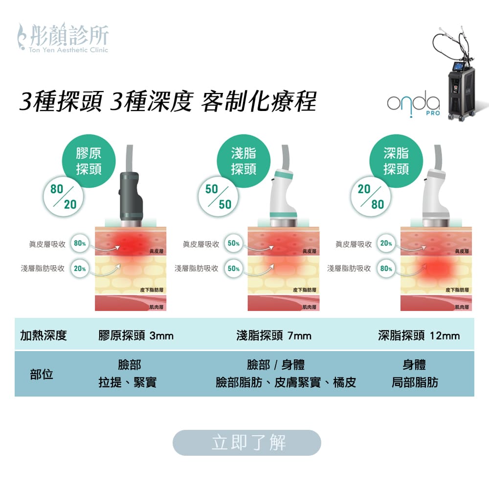 ONDA PRO效果,ONDA PRO 醫美,ONDA PRO 減脂,ONDA PRO 推薦