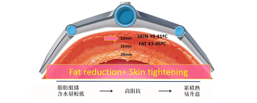 vanquish-body-contouring-btl