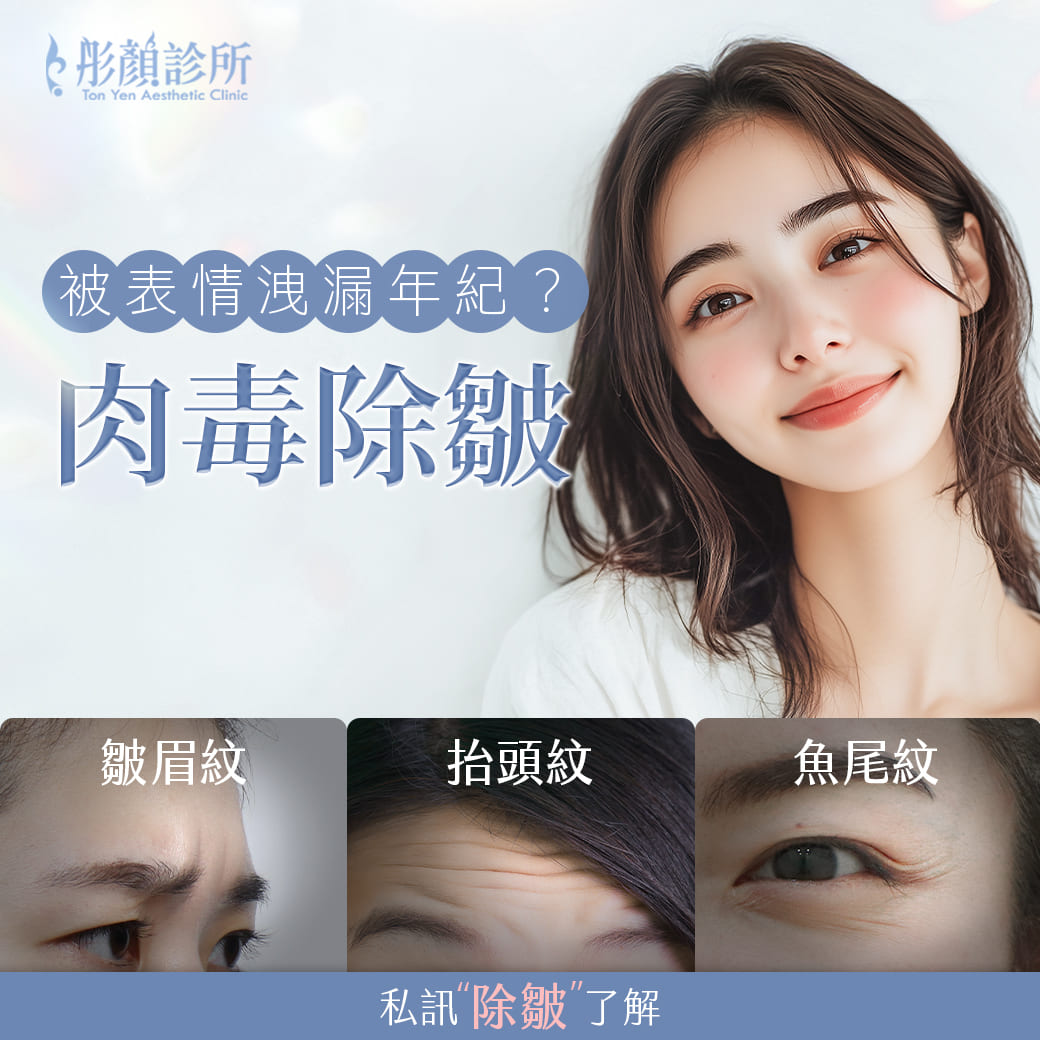 肉毒推薦-肉毒-肉毒醫美-肉毒除皺-瘦臉-瘦小腿-抬頭紋-魚尾紋-皺眉紋-肉毒小臉