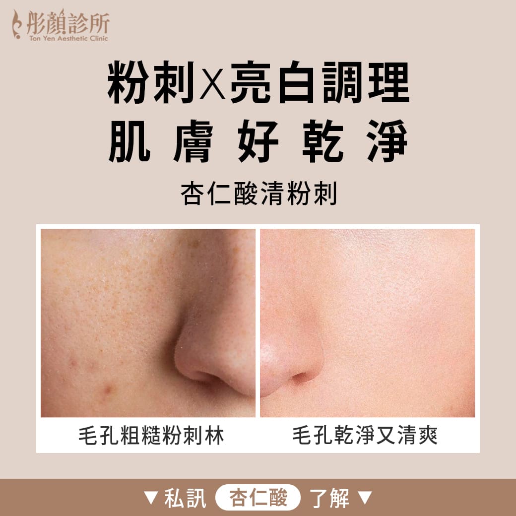 杏仁酸換膚-杏仁酸醫美推薦-杏仁酸效果-杏仁酸推薦