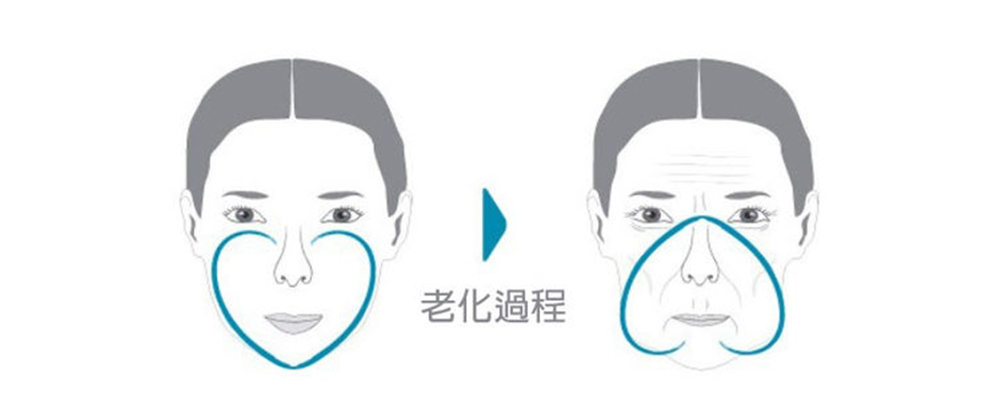 蘋果肌-法令紋-藝術面雕-彤顏診所-玻尿酸-依戀詩-童顏針-水微晶-晶亮瓷-二代童顏針-淚溝-夫妻宮-玻尿酸價格-玻尿酸費用