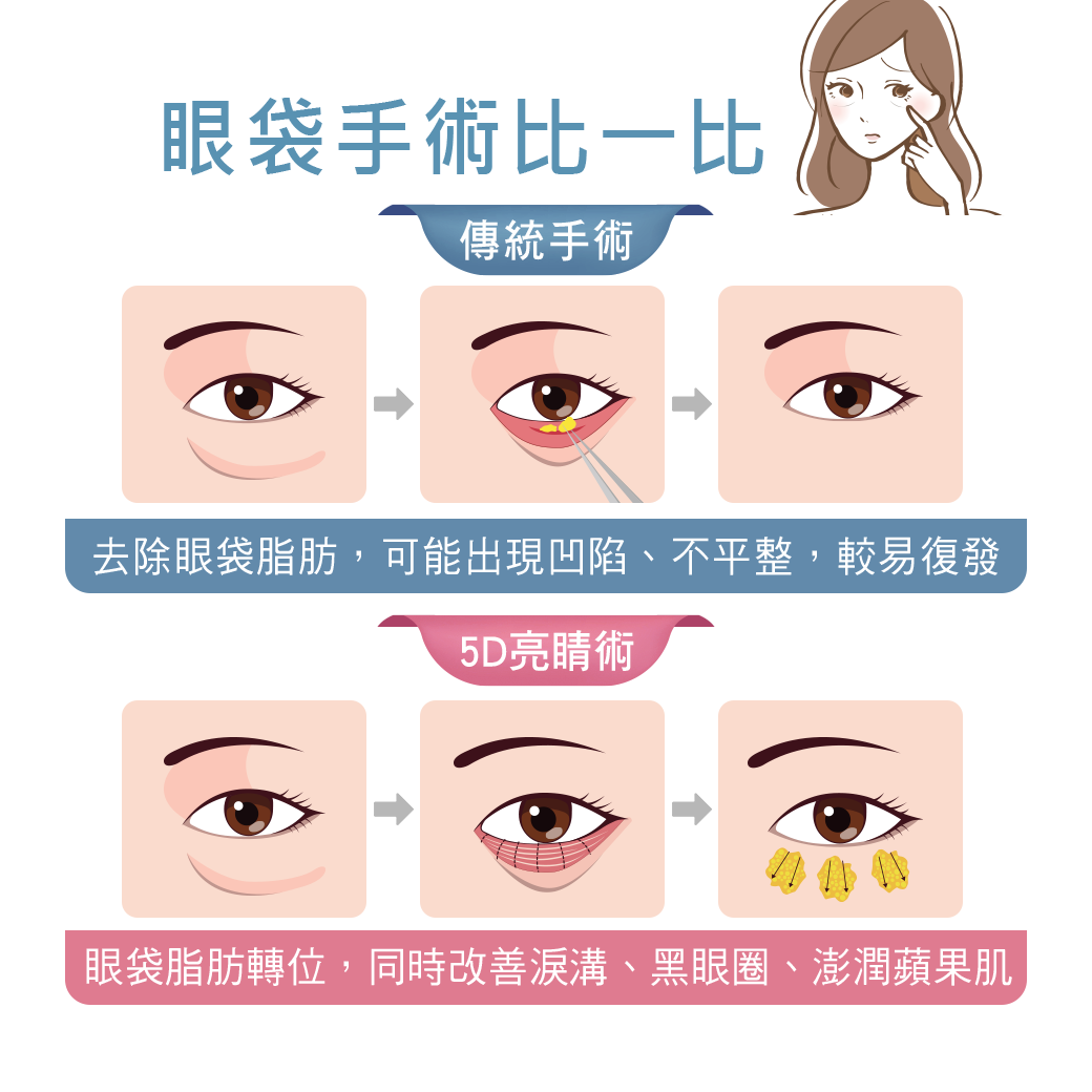 5D亮睛術手術原理與傳統眼袋手術結構對比圖